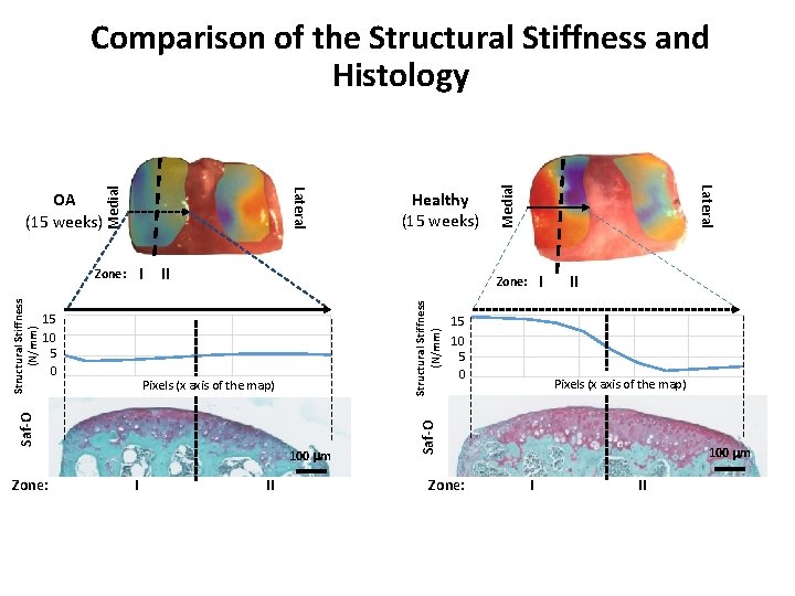 I II Structural Stiffness (N/mm) Pixels (x axis of the map) 100 mm I