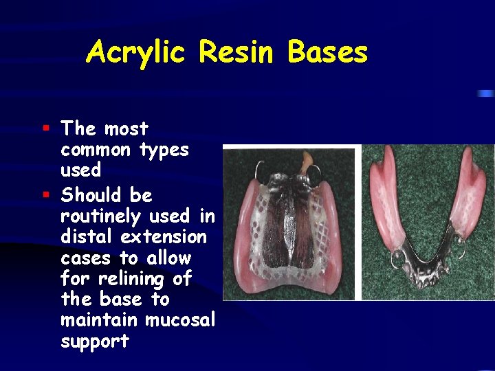 Acrylic Resin Bases § The most common types used § Should be routinely used