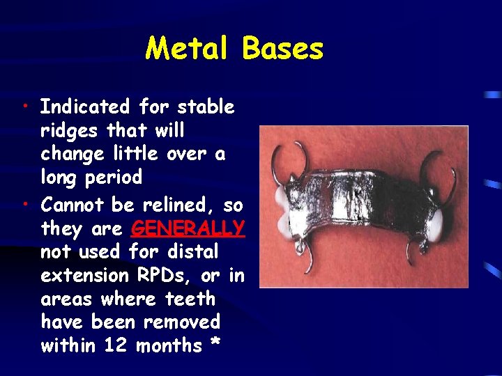 Metal Bases • Indicated for stable ridges that will change little over a long