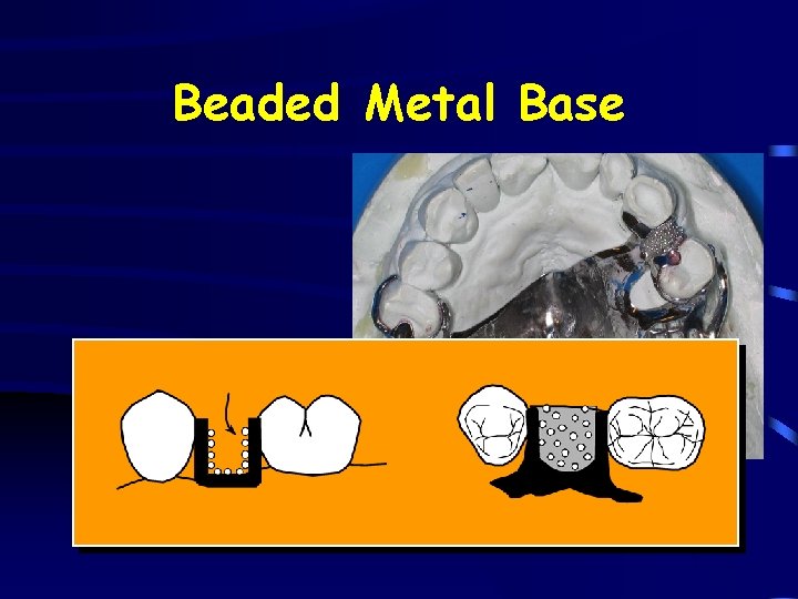 Beaded Metal Base 