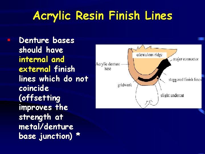 Acrylic Resin Finish Lines § Denture bases should have internal and external finish lines