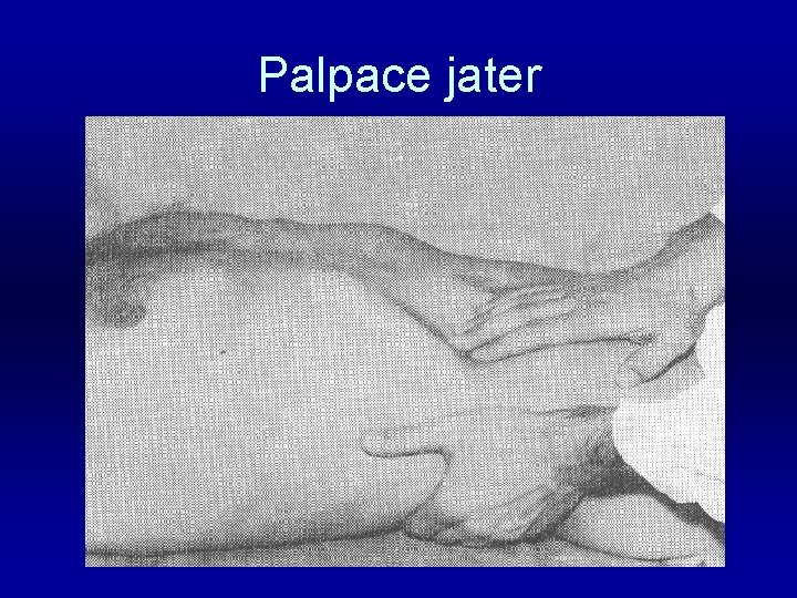 Palpace jater 