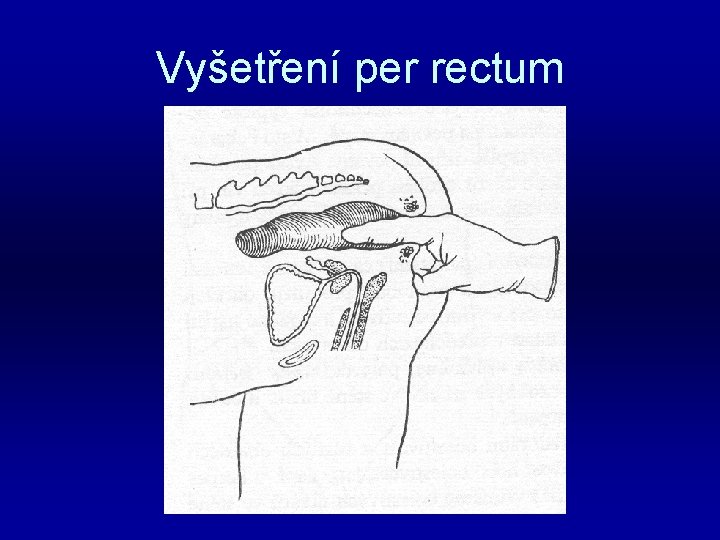 Vyšetření per rectum 