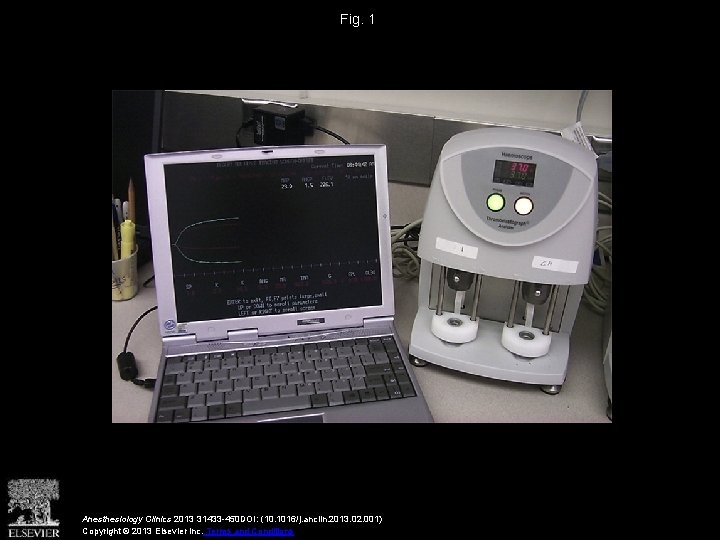 Fig. 1 Anesthesiology Clinics 2013 31433 -450 DOI: (10. 1016/j. anclin. 2013. 02. 001)