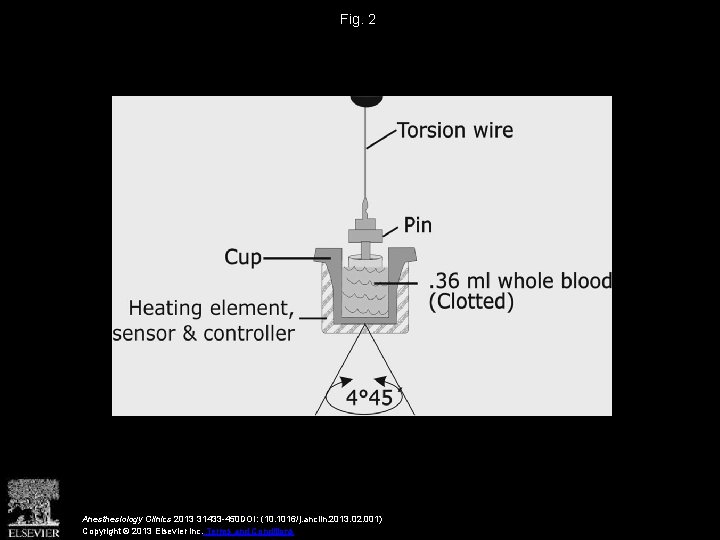 Fig. 2 Anesthesiology Clinics 2013 31433 -450 DOI: (10. 1016/j. anclin. 2013. 02. 001)