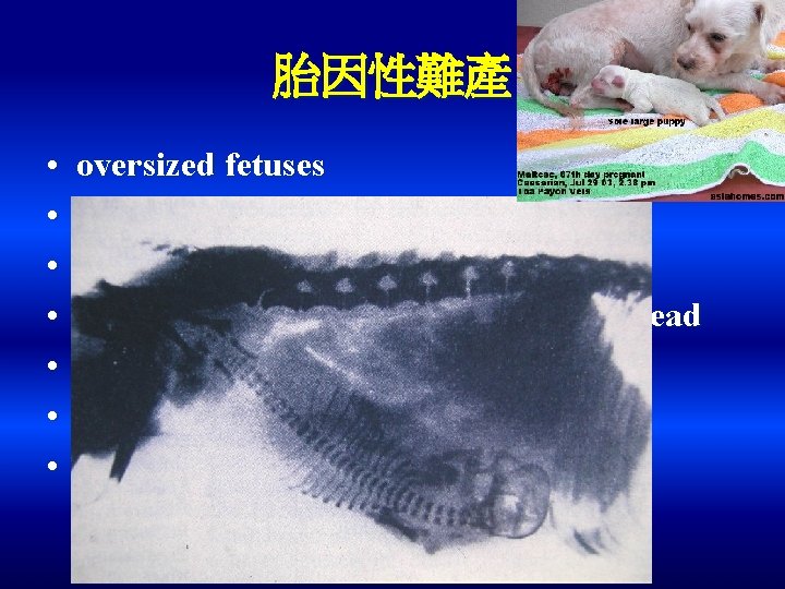 胎因性難產 • • oversized fetuses posterior presentation breech presentation lateral or downward deviation of