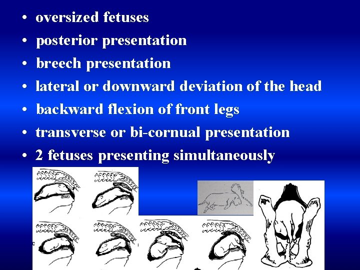  • • oversized fetuses posterior presentation breech presentation lateral or downward deviation of