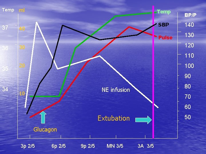 Temp ml 37 40 36 Temp BP/P SBP 140 Pulse 130 120 30 110