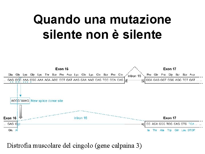 Quando una mutazione silente non è silente Distrofia muscolare del cingolo (gene calpaina 3)