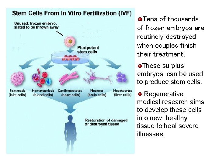 Tens of thousands of frozen embryos are routinely destroyed when couples finish their treatment.