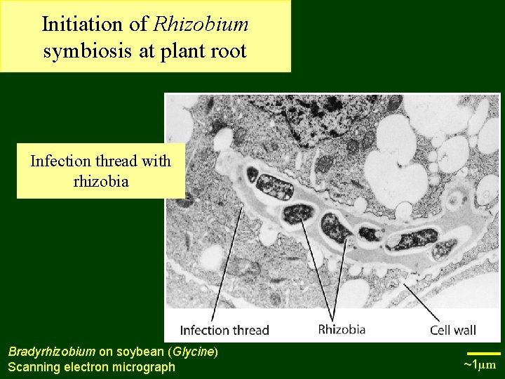 Initiation of Rhizobium symbiosis at plant root Infection thread with rhizobia Bradyrhizobium on soybean