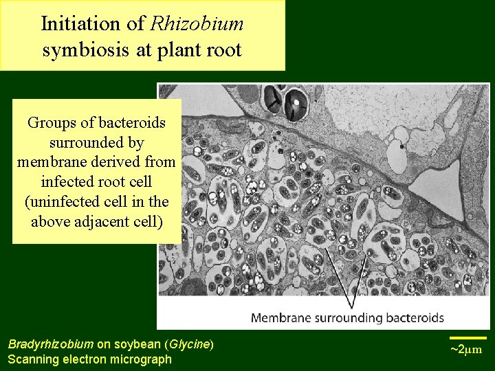 Initiation of Rhizobium symbiosis at plant root Groups of bacteroids surrounded by membrane derived