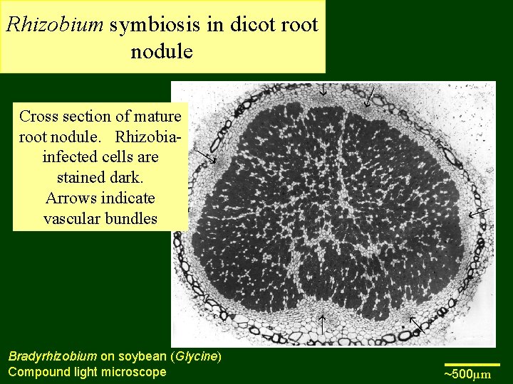 Rhizobium symbiosis in dicot root nodule Cross section of mature root nodule. Rhizobiainfected cells