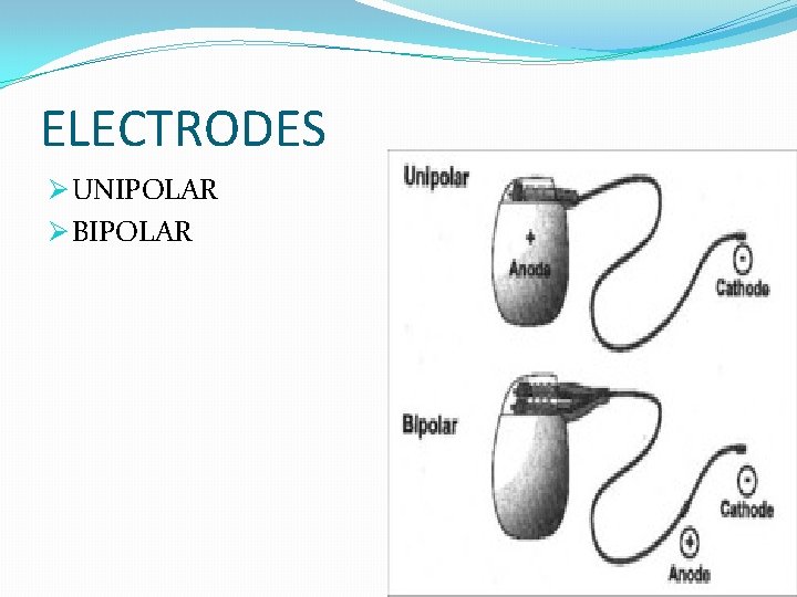 ELECTRODES Ø UNIPOLAR Ø BIPOLAR 