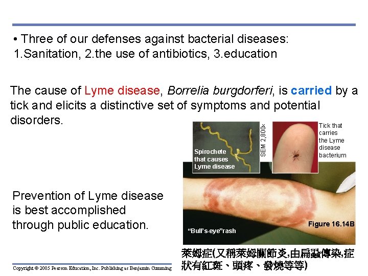  • Three of our defenses against bacterial diseases: 1. Sanitation, 2. the use