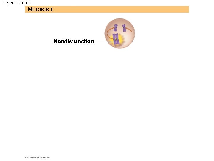 Figure 8. 20 A_s 1 MEIOSIS I Nondisjunction 