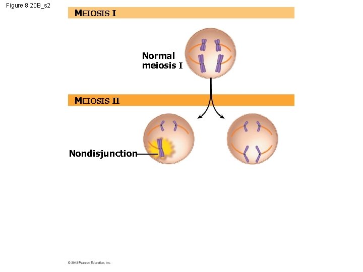 Figure 8. 20 B_s 2 MEIOSIS I Normal meiosis I MEIOSIS II Nondisjunction 