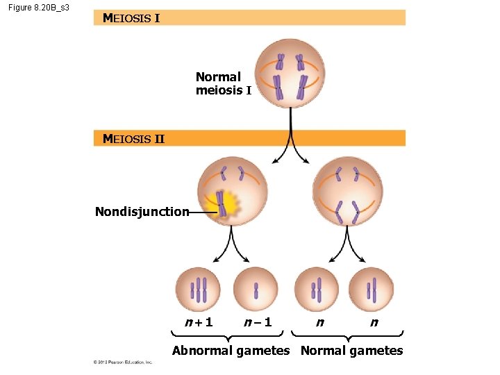 Figure 8. 20 B_s 3 MEIOSIS I Normal meiosis I MEIOSIS II Nondisjunction n