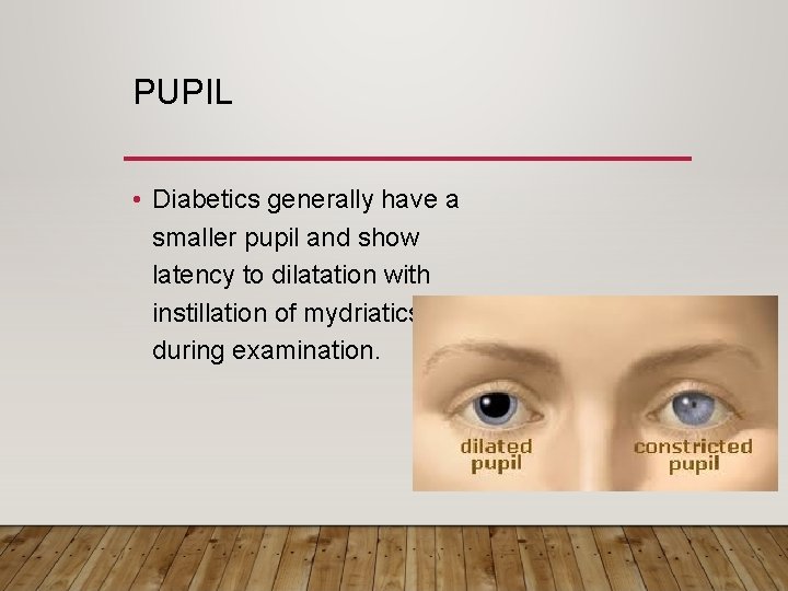 PUPIL • Diabetics generally have a smaller pupil and show latency to dilatation with