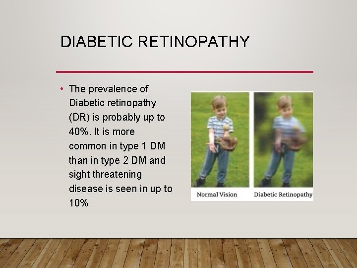 DIABETIC RETINOPATHY • The prevalence of Diabetic retinopathy (DR) is probably up to 40%.