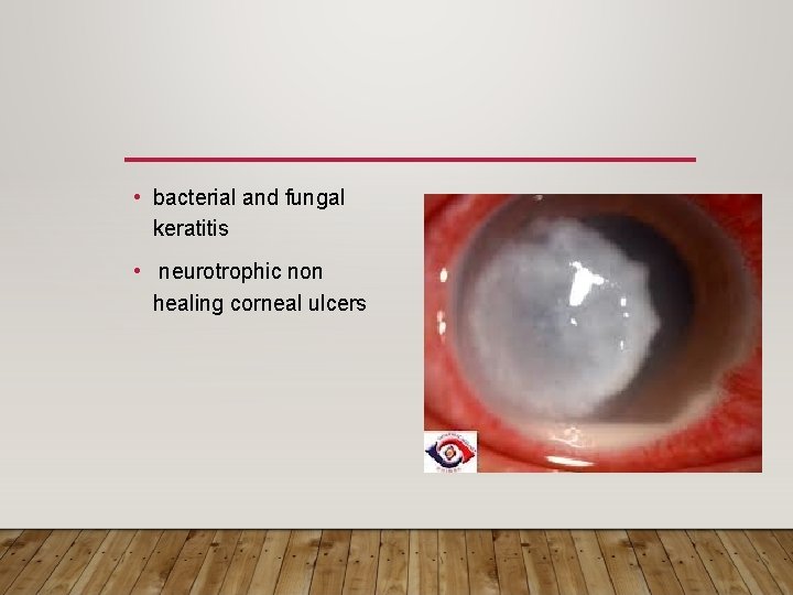  • bacterial and fungal keratitis • neurotrophic non healing corneal ulcers 