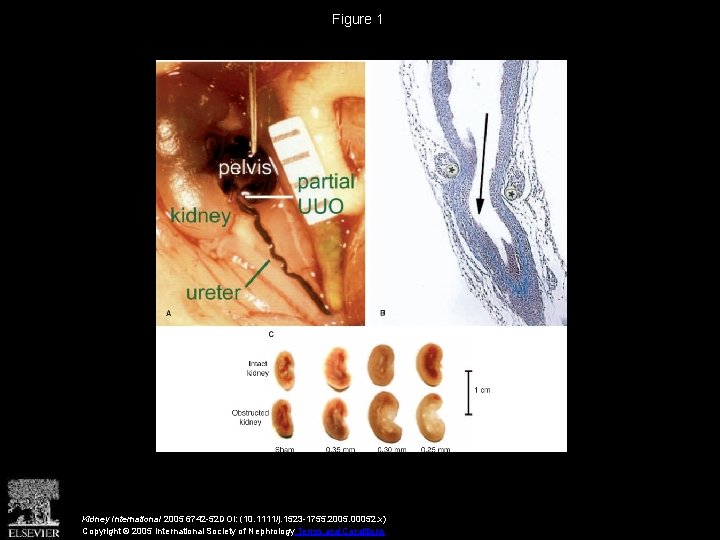 Figure 1 Kidney International 2005 6742 -52 DOI: (10. 1111/j. 1523 -1755. 2005. 00052.