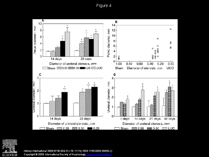 Figure 4 Kidney International 2005 6742 -52 DOI: (10. 1111/j. 1523 -1755. 2005. 00052.