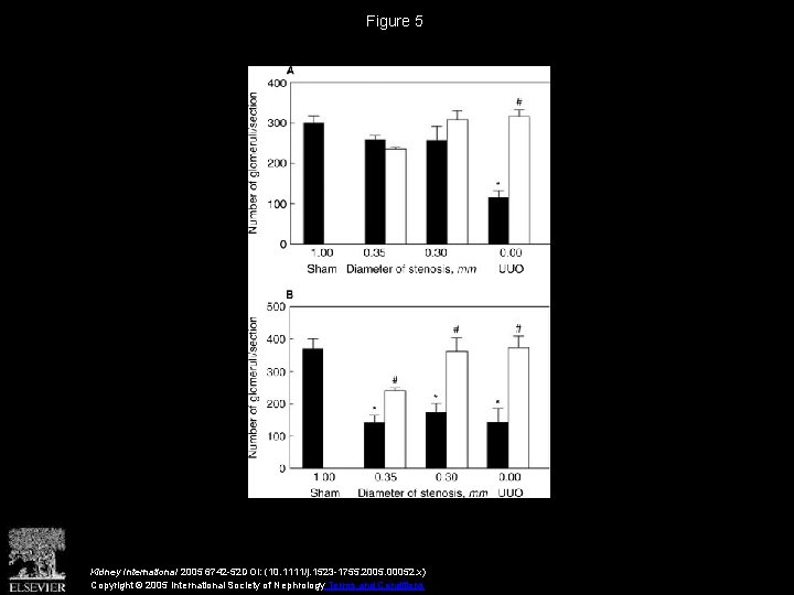 Figure 5 Kidney International 2005 6742 -52 DOI: (10. 1111/j. 1523 -1755. 2005. 00052.
