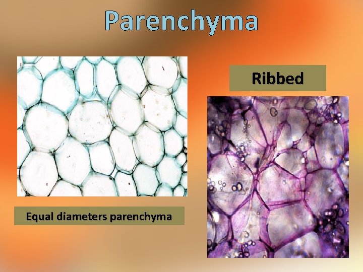 Parenchyma Ribbed Equal diameters parenchyma 
