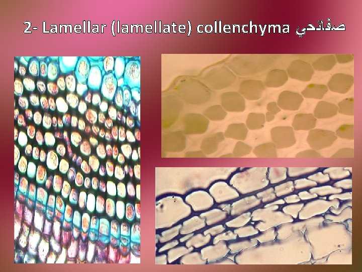 2 - Lamellar (lamellate) collenchyma ﺻﻔﺎﺋﺤﻲ 
