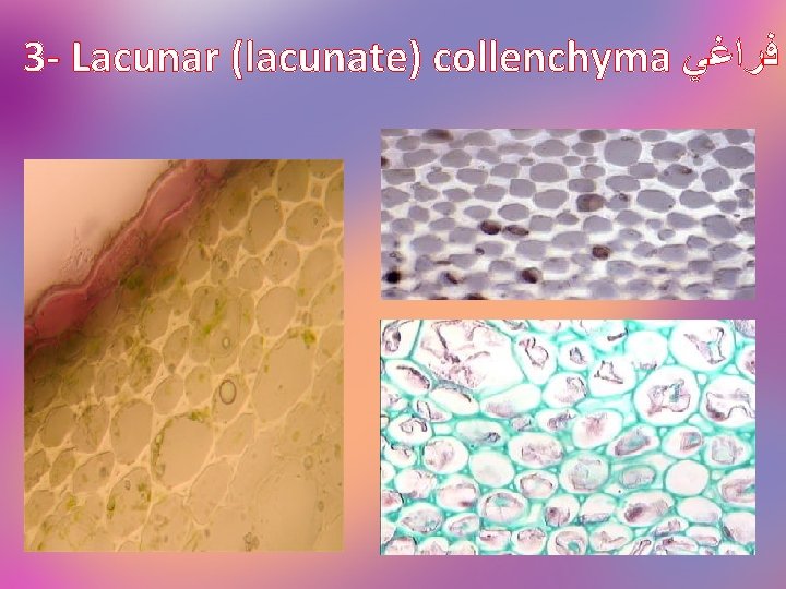 3 - Lacunar (lacunate) collenchyma ﻓﺮﺍﻏﻲ 
