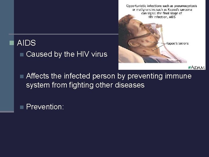 n AIDS n Caused by the HIV virus n Affects the infected person by