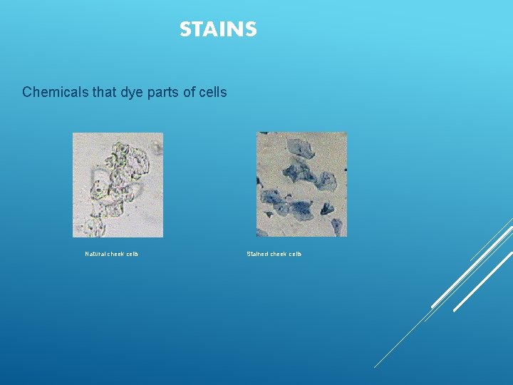 STAINS Chemicals that dye parts of cells Natural cheek cells Stained cheek cells  STAINS Chemicals that dye parts of cells Natural cheek cells Stained cheek cells