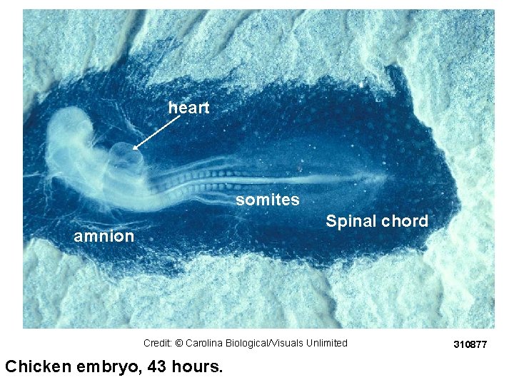 heart somites Spinal chord amnion Credit: © Carolina Biological/Visuals Unlimited Chicken embryo, 43 hours.