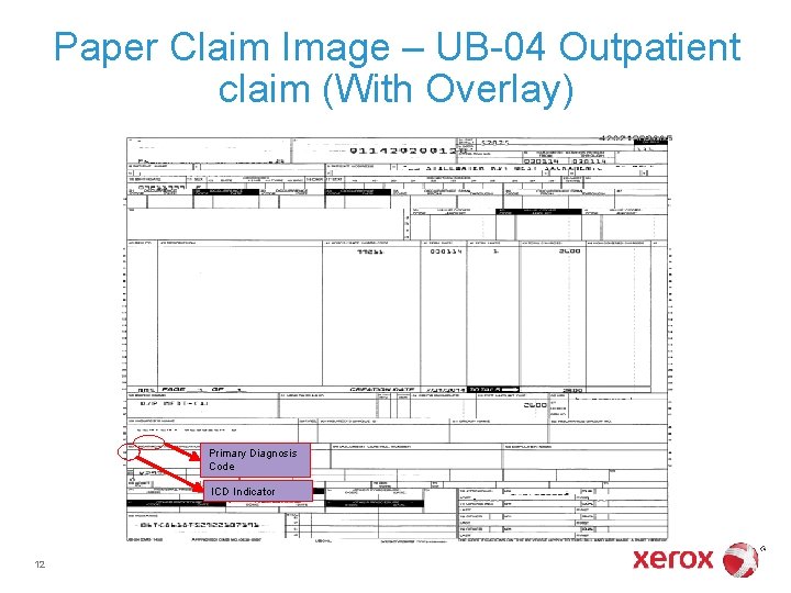 Paper Claim Image – UB-04 Outpatient claim (With Overlay) Primary Diagnosis Code ICD Indicator