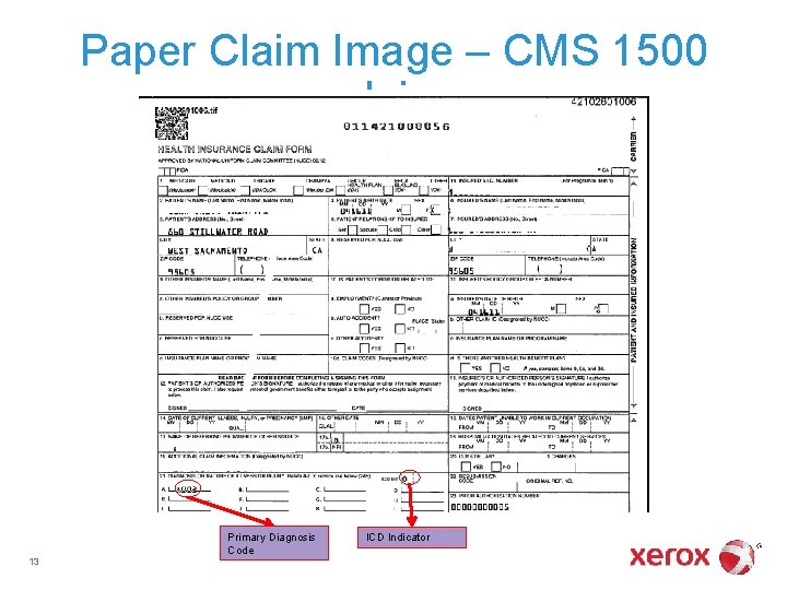 Paper Claim Image – CMS 1500 claim Primary Diagnosis Code 13 ICD Indicator 