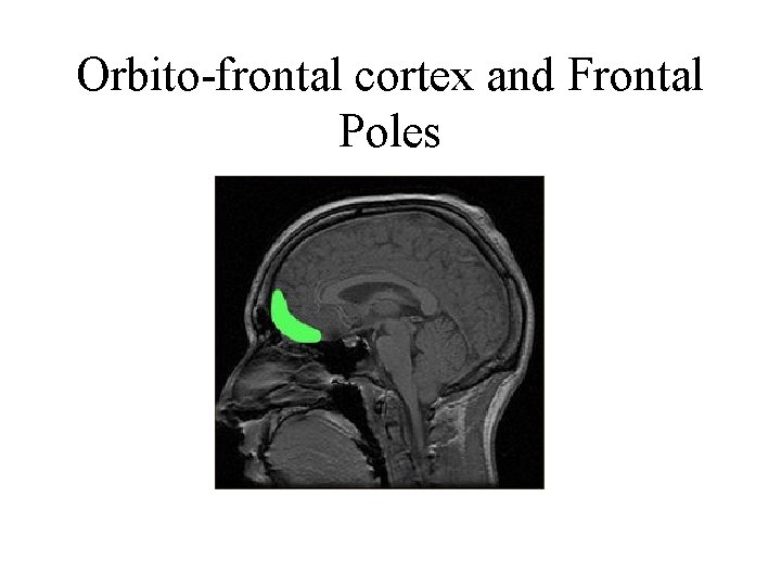 Orbito-frontal cortex and Frontal Poles 