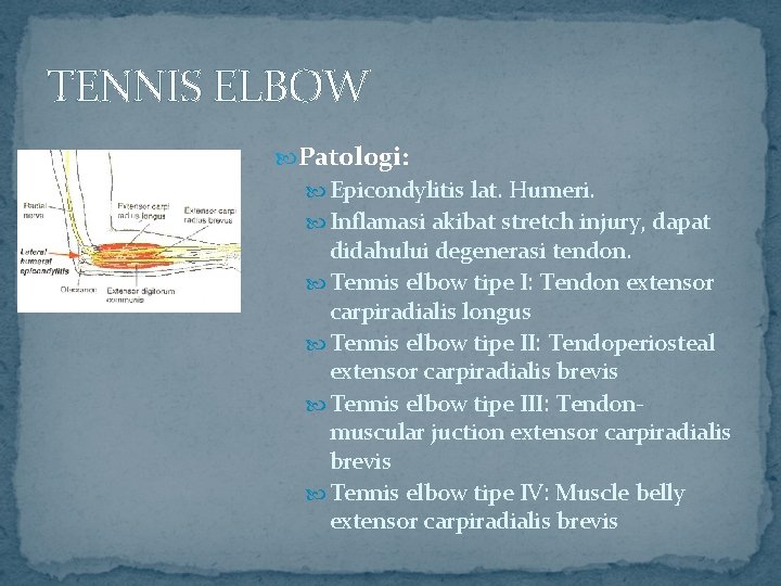 TENNIS ELBOW Patologi: Epicondylitis lat. Humeri. Inflamasi akibat stretch injury, dapat didahului degenerasi tendon.