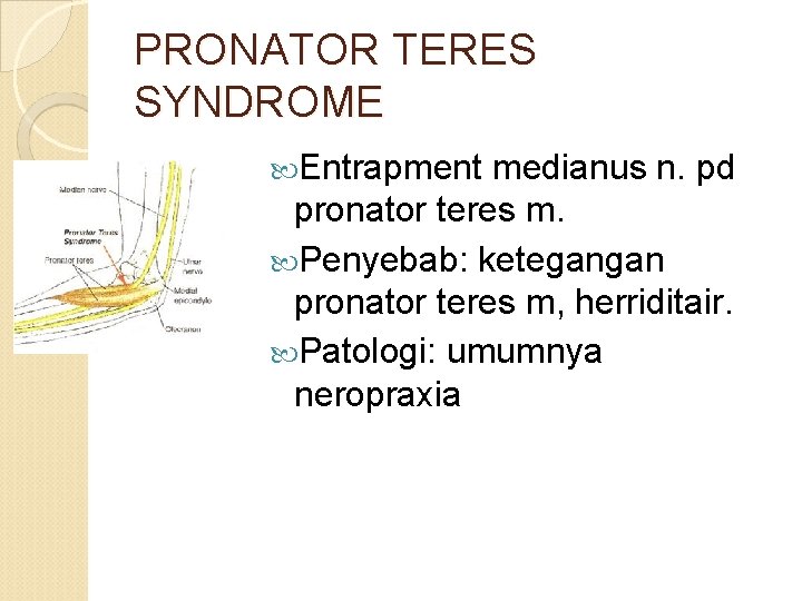 PRONATOR TERES SYNDROME Entrapment medianus n. pd pronator teres m. Penyebab: ketegangan pronator teres