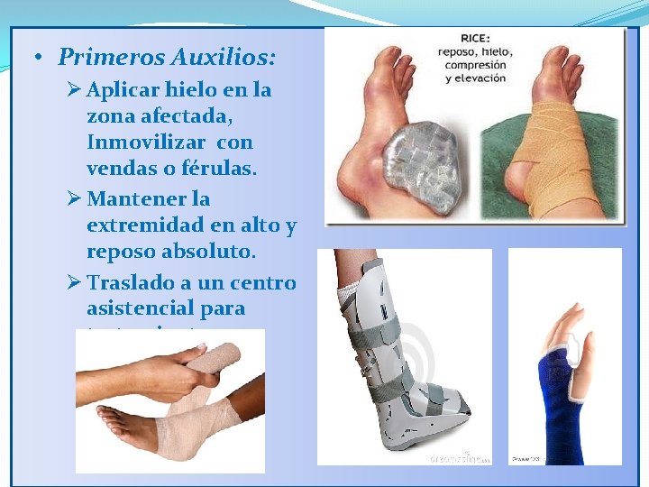  • Primeros Auxilios: Ø Aplicar hielo en la zona afectada, Inmovilizar con vendas