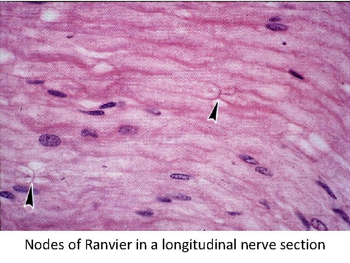 Nodes of Ranvier in a longitudinal nerve section 