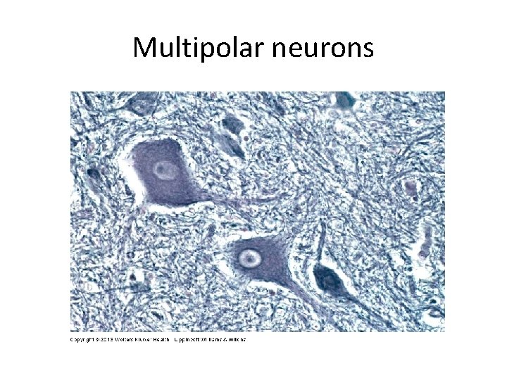 Multipolar neurons 