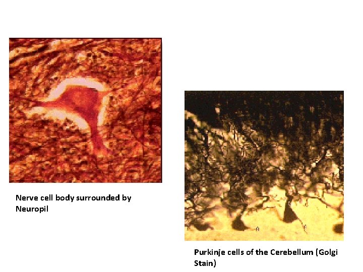 Nerve cell body surrounded by Neuropil Purkinje cells of the Cerebellum (Golgi Stain) 