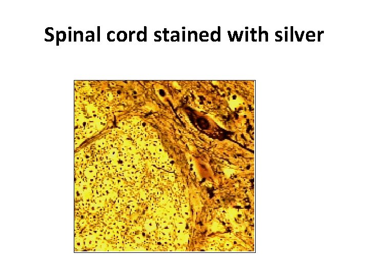 Spinal cord stained with silver 