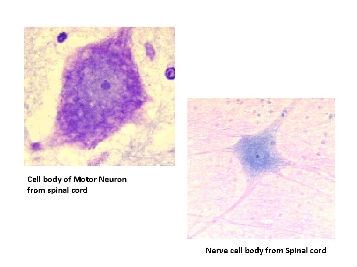 Cell body of Motor Neuron from spinal cord Nerve cell body from Spinal cord