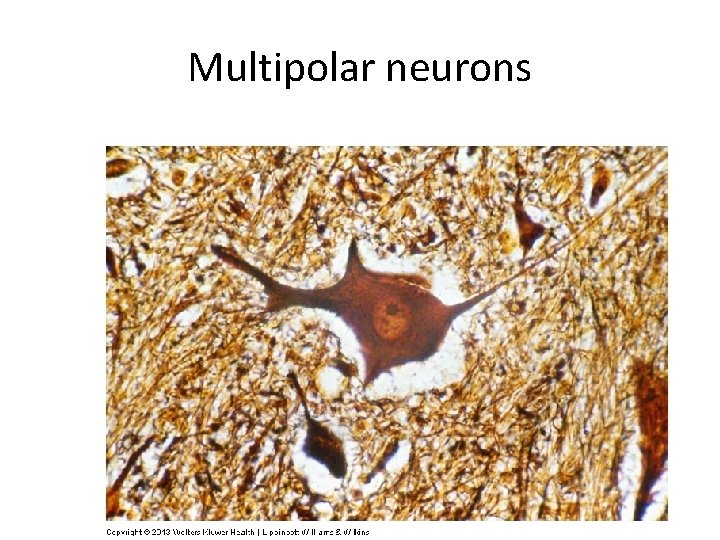 Multipolar neurons 