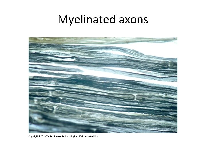 Myelinated axons 