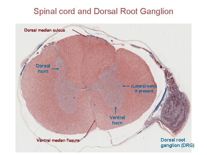 Spinal cord and Dorsal Root Ganglion Dorsal median sulcus Dorsal horn (Lateral horn) if