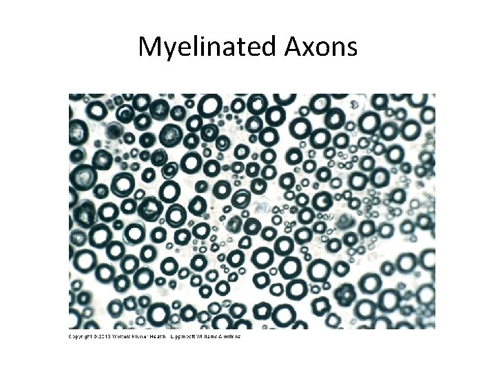 Myelinated Axons 