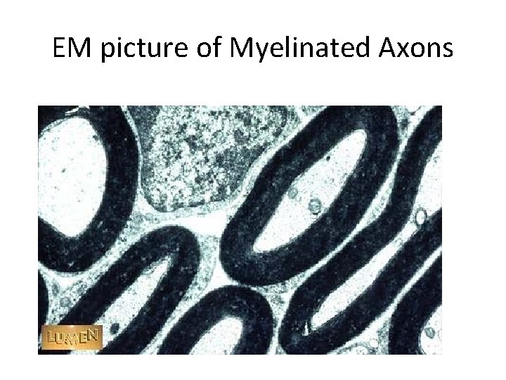 EM picture of Myelinated Axons 